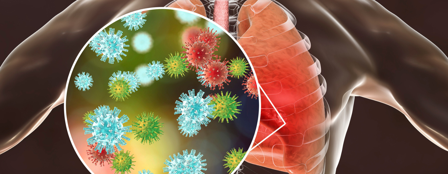 Pneumonia: sintomas, diagnóstico e tratamento